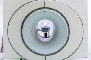 ASDのMRIによる脳画像の説明は医師にどのように求めるべきか？