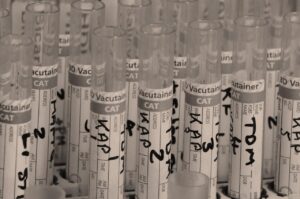 ASDの臨床試験参加について医師に相談する際のポイントは？